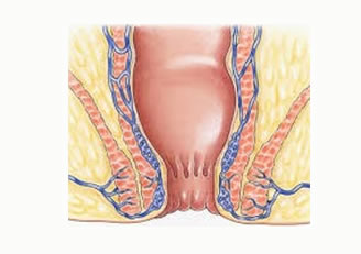 Anorectal Diseases